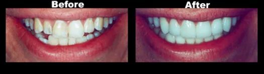 Case_10